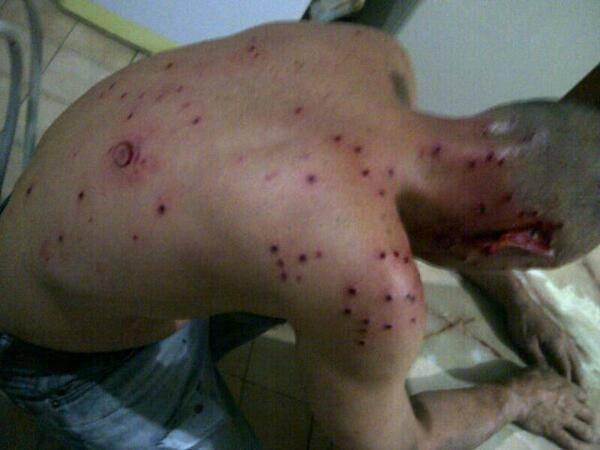 "<a href="/Gilbert_Olarte/">#ColombianoIndignado</a>: l: Ellos si están dejando el pellejo en esto! No los dejen solos!   " <a href="/rmartinelli/">Ricardo Martinelli</a> @Cnne