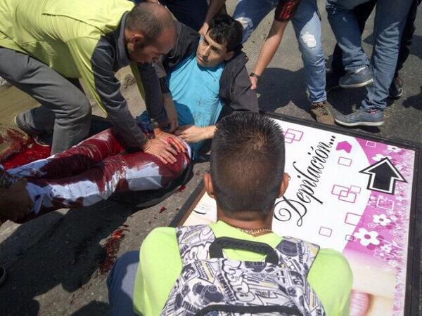 AnonsVenezuela's tweet photo. Herido de bala en la isabelica espiga de oro. #RT http://t.co/QCKbkRH8BE