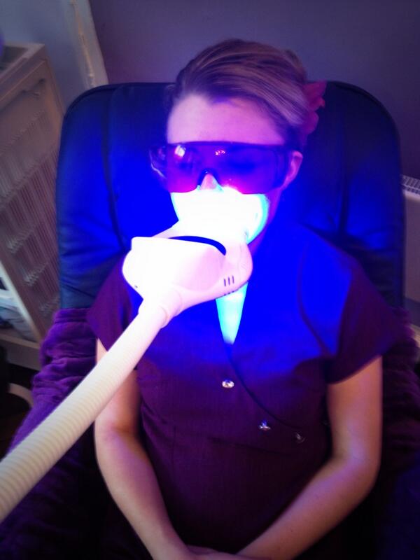 beauthaven05's tweet photo. #megawhite tooth whitening in progress!! @megawhiteUK http://t.co/VNT6bjAZWB