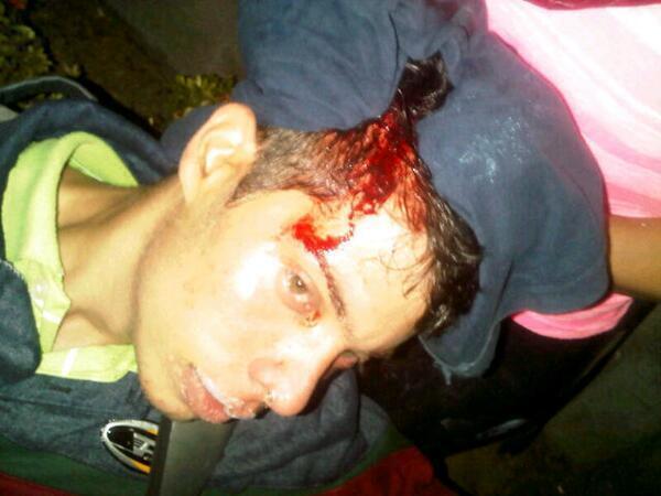 manuelomana1501's tweet photo. herido en San Jacinto,  #Maracay, la Policia de Aragua y Colectivos reprimiendo 9:27pm #12M #ResistenciaVzla http://t.co/6IQ2Zm4Fjk”