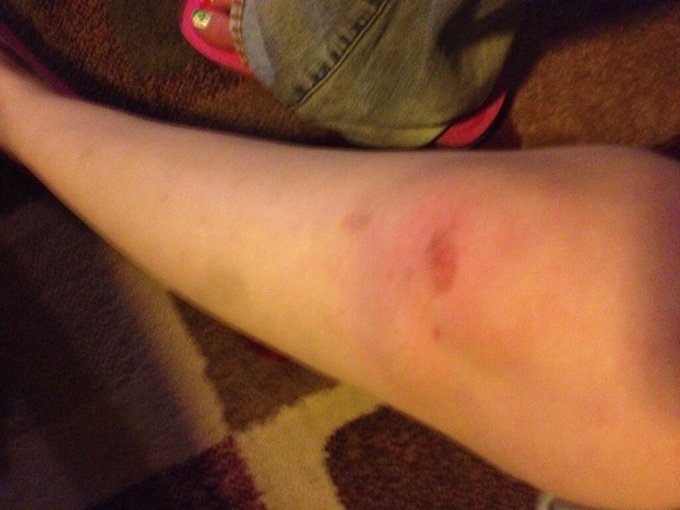 Wow!!! I can't believe I just fell.... I never fall! That's gonna leave a bruise! http://t.co/TEjHYO<a href="/tag/manyvids"class="tags"><span>#manyvids</span></a>