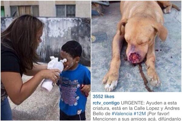 A mother cares for her son who's been been affected by tear gas granades thrown by the same party that hurt this dog