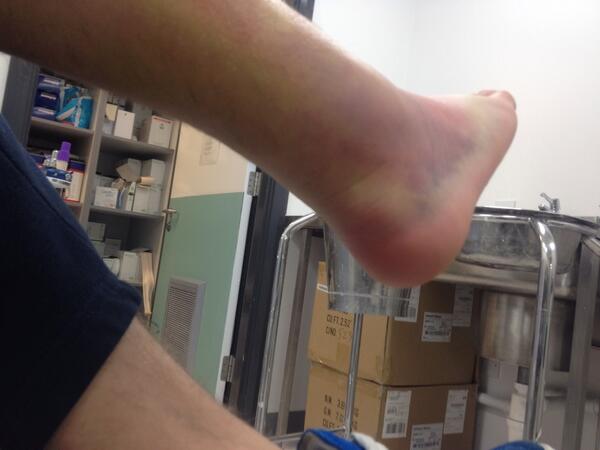 Lee_Hughes97's tweet photo. Operation next week 😭 http://t.co/lKksy45f1V