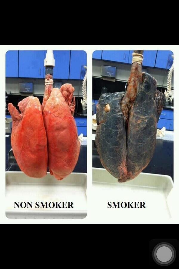 <a href="/paula_jn_davis/">Paula Davis</a> You got this!!! Stay strong💪this pic stopped me every time I nearly caved😳