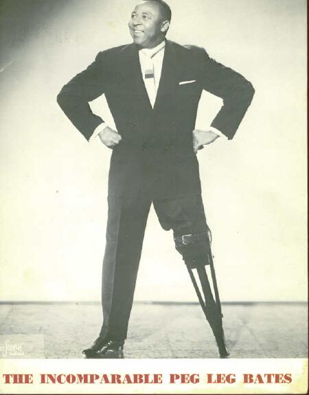 3DPrintMED's tweet photo. Throwback to when Dubois L Parmelee first discovered a method to attach a prosthetic limb onto the body #tbt http://t.co/eFCyR20zkt