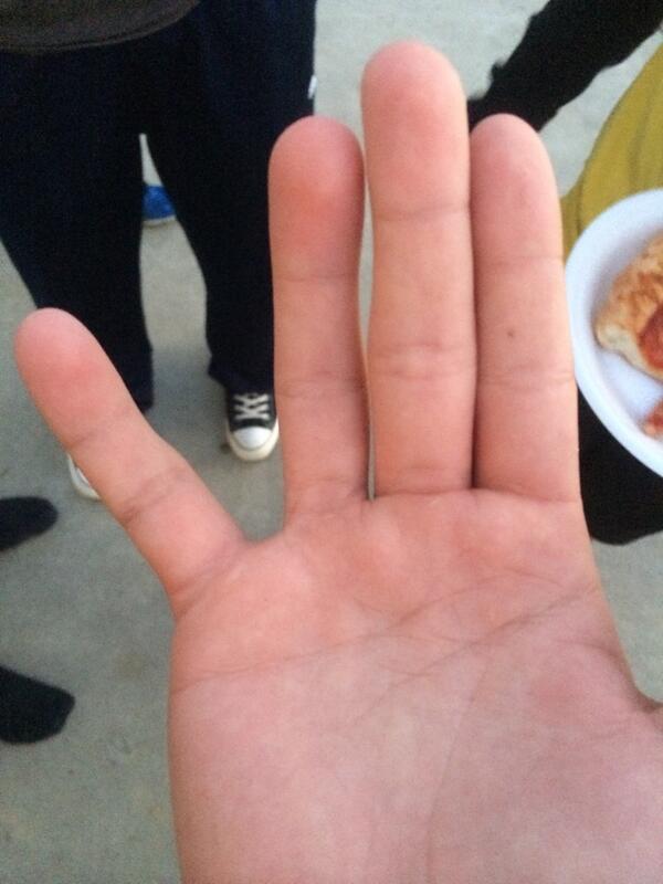 noahriley_'s tweet image. FCA #DISLOCATED