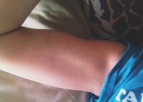 FitForSummer7's tweet photo. Love my arms 😊 http://t.co/eRLmZVHWXF