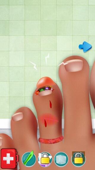BillyCuadrado's tweet photo. Nail Doctor - Toe Nail Surgery  https://t.co/TIQRIGLTyp http://t.co/j7nkZzZuKZ