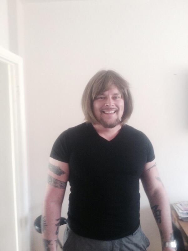 MathewHodgman's tweet photo. My brother showing off his new hair transplant. http://t.co/32HgK2V8W9
