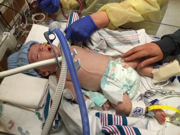 TeacherCast's tweet photo. My little @EduTriplets made it through his trach surgery. #nicu #babyedchat @MarchofDimes http://t.co/78vxlKyKrz