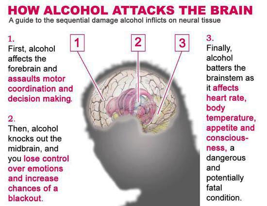 DailyHealthTips's tweet photo. How Alcohol affects your Brain &amp; Body http://t.co/UmO5ndzvPg http://t.co/UGYHLzXlag