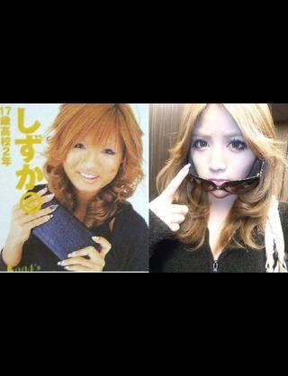 元美容整形医の戯言 武藤静香 整形前 相互フォロー Http T Co Xoluplangh