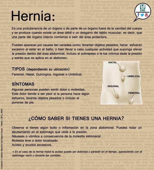 como+saber+si+ya+no+tengo+hernia+hiatal