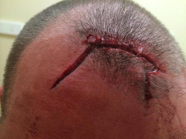 Hannah Summers tweet media