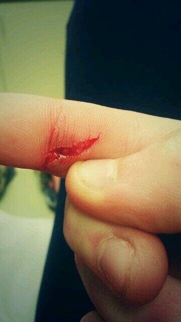 jwalker112's tweet photo. Who needs the color fest when you can destroy your finger with a car door &amp; hang at instacare for days.;) @ky_rosey http://t.co/5byHBLlYGg