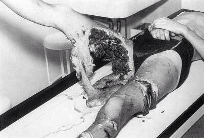 HorrorEnFotos's tweet photo. Ataque de tiburón 1960. http://t.co/yPFxlvFfFv