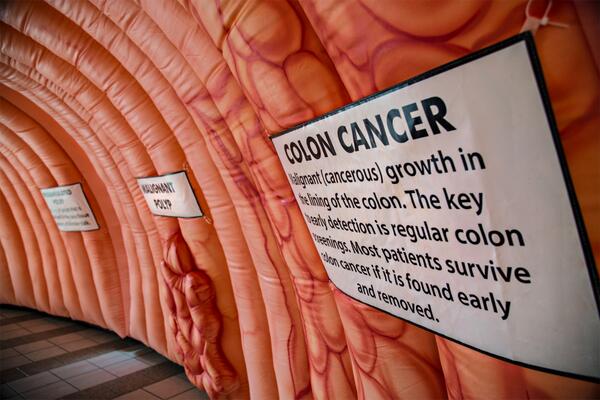 BeaumontHealth's tweet photo. @DollarShaveClub If viewing the real thing isn't for you, take a look at our 32 feet long inflatable colon. #DSColon http://t.co/VAEa0n5jRm