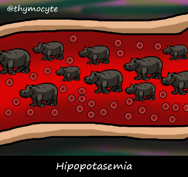 thymocyte's tweet photo. Hipopotasemia, visión histológica: http://t.co/R5dsDuWXMm