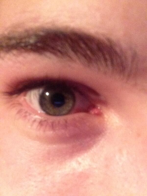 Martin Bigeard tweet media