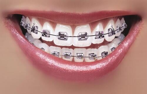 AllThingsCLEVE's tweet photo. Wow! This girl STILL has 32 perfect brackets!! #MarchMadness http://t.co/i2CRyORWYK