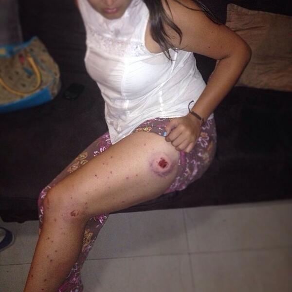 sntpvenezuela's tweet photo. Así quedó @DayanaMendezA luego ser detenida injustamente mientras hacía su trabajo como periodista en #Carabobo http://t.co/qYB5c58Ny6