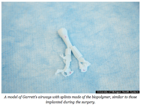 HuffPostTech's tweet photo. How 3-D printers are saving babies' lives one breath at a time (http://t.co/Dg0lci1mr2) http://t.co/6bXTxeAerx