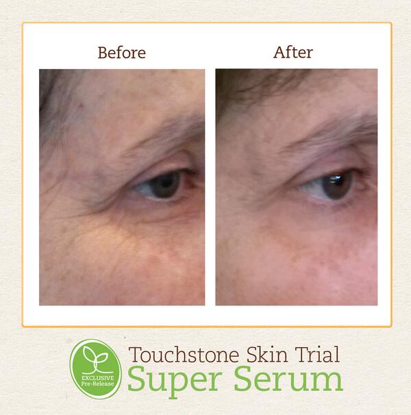 After 90 days, Barbara has transformed the look of her skin, thanks to the Touchstone #SuperSerum.