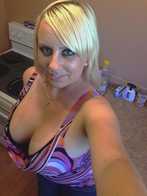 Starting to feel much better!!! Just over two weeks post-op @Boobs_69 @BoobCritic @HugeBoobPics http://t<a href="/tag/shoeporn"class="tags"><span>#shoeporn</span></a>