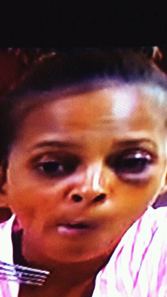 MzTiNk89's tweet photo. Lmbo...... so sundy said she still pretty with a black eye..... what yall think???? Lol http://t.co/e0rSW9WTsn