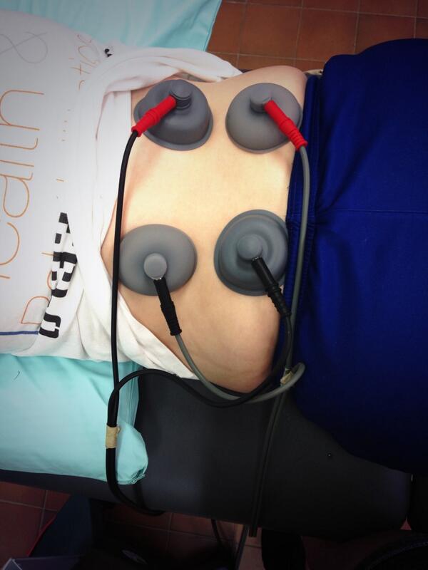 aspire_h_r's tweet image. Interferential treatment anyone? #interferential #treatment #rehabilitation