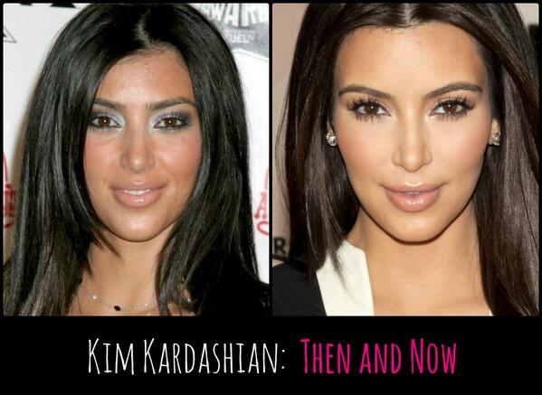 Kim Kardashian Now and Then Before