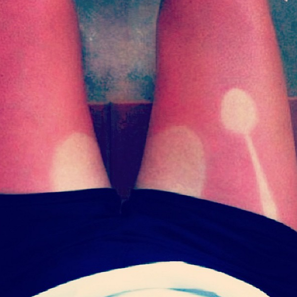 GingerProblems's tweet image. Note to self: don't fall asleep outside.