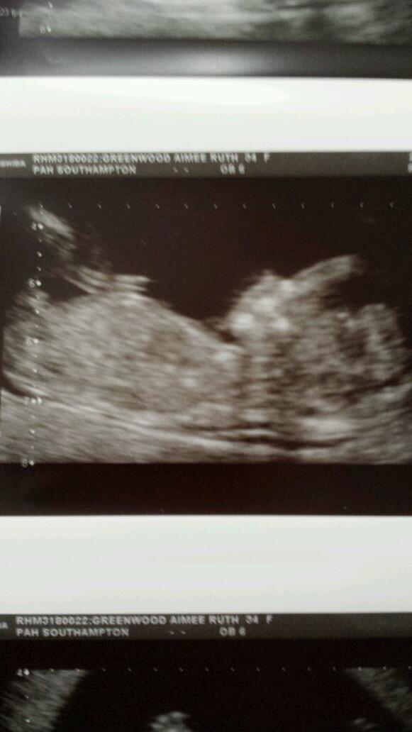 inkylady1979's tweet photo. I am loving sharing this pic of my little one :) #pregnantandpleased http://t.co/BK8B1vzxqt