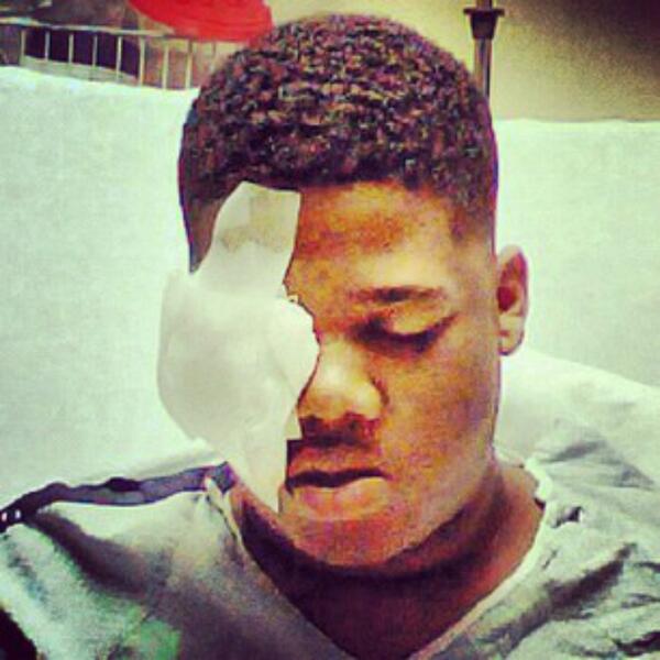 __OfficialNICK's tweet photo. #DoeBackThursday 2009 , Doe B after surviving a shot to the eye . @DJFRANKWHITE @Tip http://t.co/i7yPM4gQqm