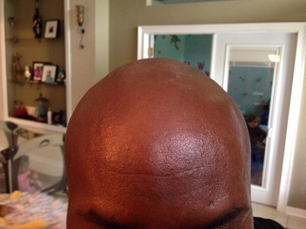 linkzillaJimmy's tweet image. Midlife crisis.. No more hair