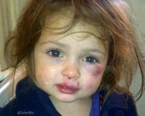 TuiterHits's tweet photo. Tienes 1 segundo para darle RT si estas en contra del maltrato infantil. http://t.co/Ib6gAkZpW6