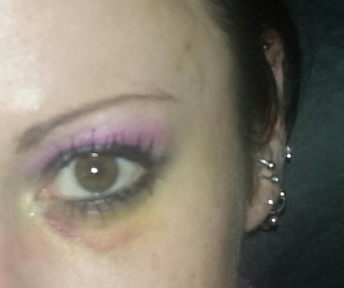 Starting to heal. ... http://t.co/4zQVgk0R2r