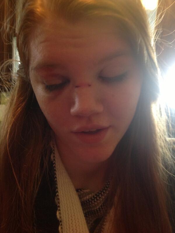 eryn0renee's tweet image. #throwbackthursday #siblingsalute #brokenstuff ❤️❤️