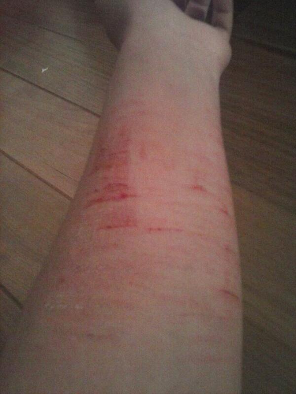 SuicidalJO tweet picture