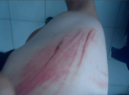 jankielc_'s tweet image. To much skating today! #SlideJam