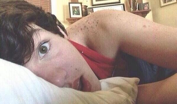 Twerk_Magcon69's tweet image. Aaron's freckles&amp;gt;&amp;gt;&amp;gt;