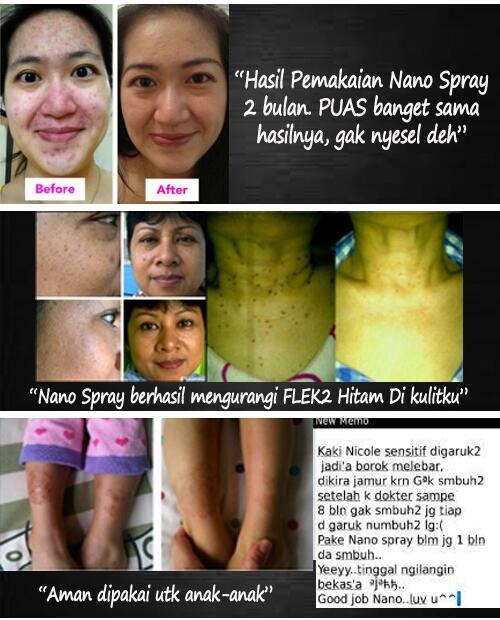 msh pke krim2 perawatan g aman? udah g jaman:),saatnya pake nanospray:),cantik tnp kosmetik.pin:24db8320