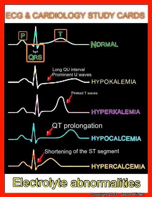 IlindelatorreMD's tweet photo. Electrolyte abnormalities. Source iheartdinOsaurs. http://t.co/i68NeJTmEb