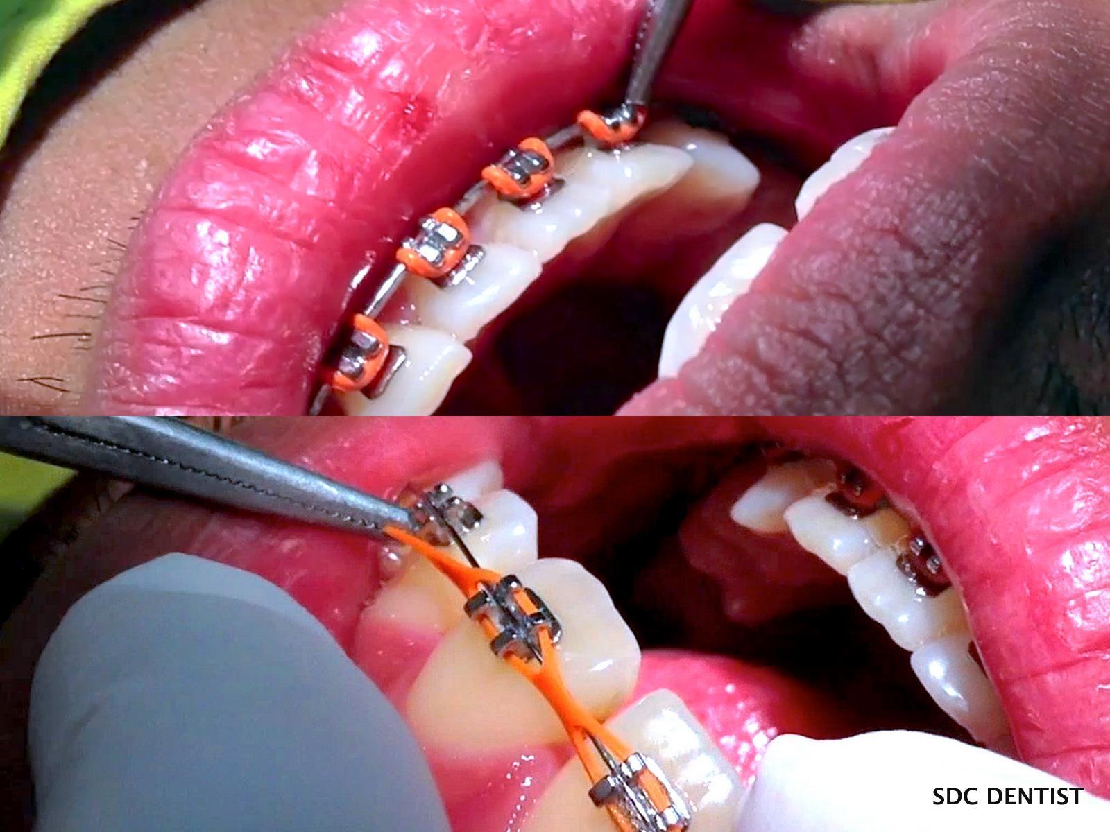 หมอฟัน on X: หมอฟัน On X: