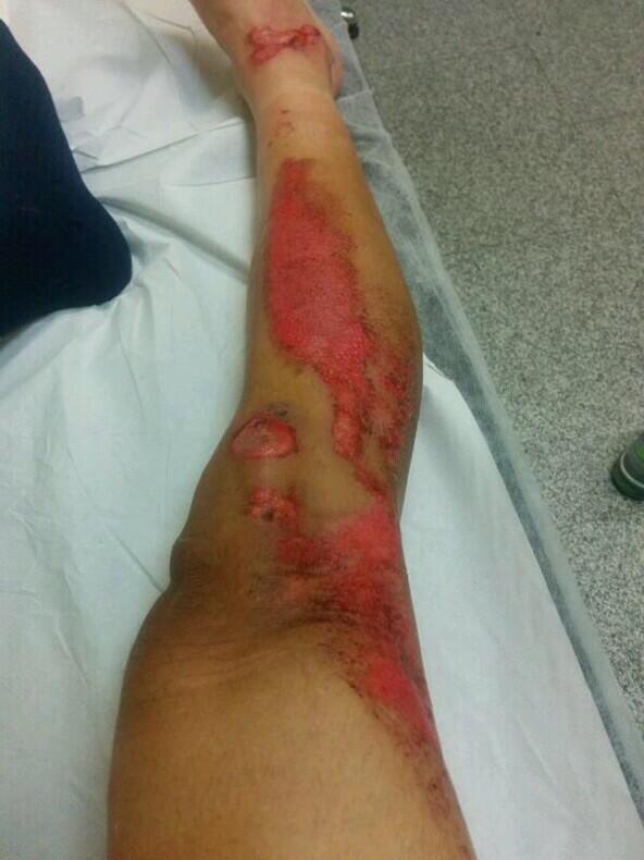 "<a href="/m_marchante/">Mónica Marchante</a>: Esta pierna es de <a href="/franventoso/">Fran Ventoso</a> y va a correr el Tour de Flandes este domingo. #deotrapasta!!!!!!! "