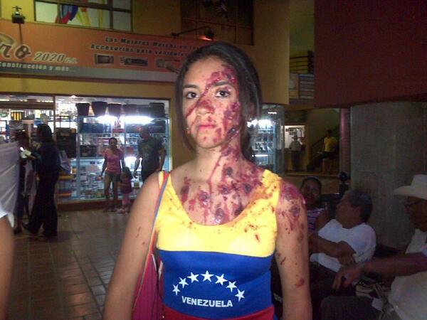 estebangerbasi's tweet photo. #TerrorismoDeEstado IMPACTANTE #MovPlazaYZamora CC Rojo Casarapa http://t.co/nApWyHV1Wa