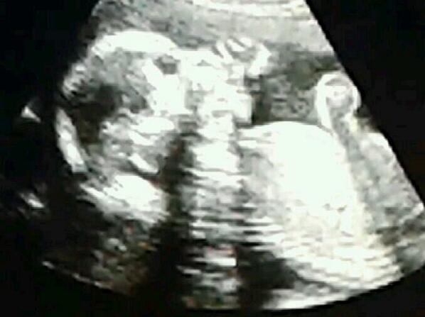 robertoescal's tweet image. Un pais luchando por su presente,  y mi hijo Esteban creciendo  en espera de tener un futuro en Venezuela.