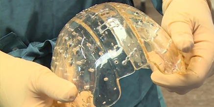 HP's tweet photo. Insane in the membrane. Neurosurgeons at @UMCUtrecht successfully implant 3D printed skull: http://t.co/lmks6AwvH7 http://t.co/xkBwjbMR6G