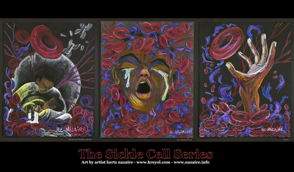 Nazaire73's tweet image. Living #LIFE you can find times that are painful and annoying not everyday is Painless... #SickleCell PAIN #Art RT