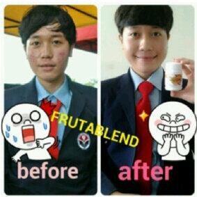 Ratu_HWI's tweet photo. Iseng Pake frutablend bisa kayak gini loh dlm 15 HR :D BPOM . Mau? Add pin : 273BBB79 @apaajaIKLAN @JatengIKLAN http://t.co/8Cq9qKf1fu